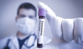 coronavirus muestra