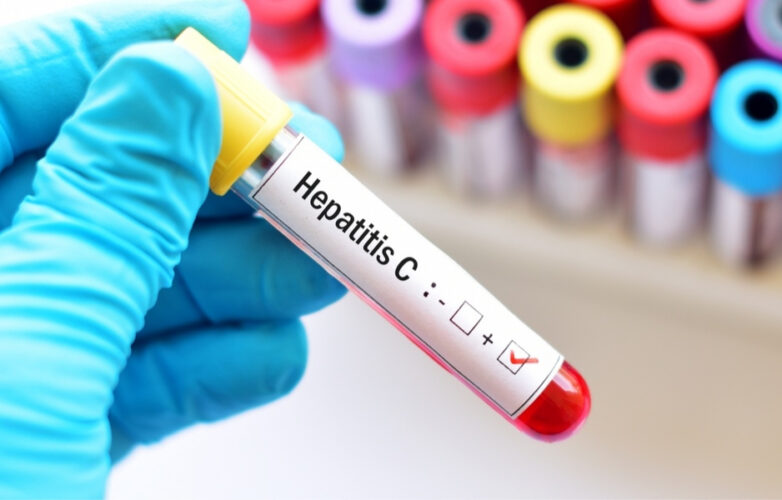 hepatitis-c-tratamiento-gr